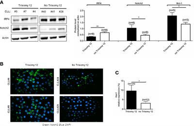 Notch2 Increases the Resistance to Venetoclax-Induced Apoptosis in Chronic Lymphocytic Leukemia B Cells by Inducing Mcl-1